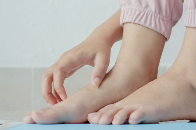 Tips Usir Gatal-Gatal di Kaki